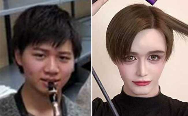 Matt整形前, マットすっぴん写真 _ Mattの整形前の昔のすっぴん顔が別人過ぎてヤバイ! – XUZBE
